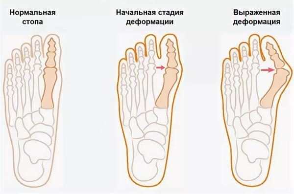 5 причин не покупать дешевую обувь