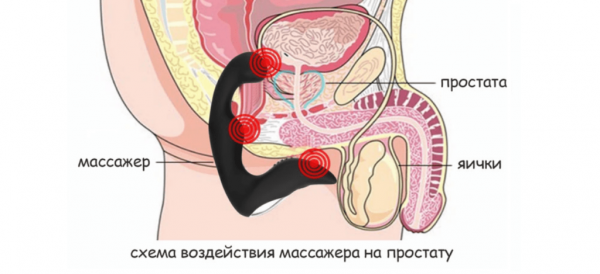 Массажер простаты — принцип действия, как использовать, результат