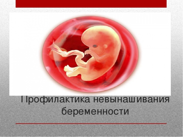 Почему на ранних сроках бывают выкидыши
